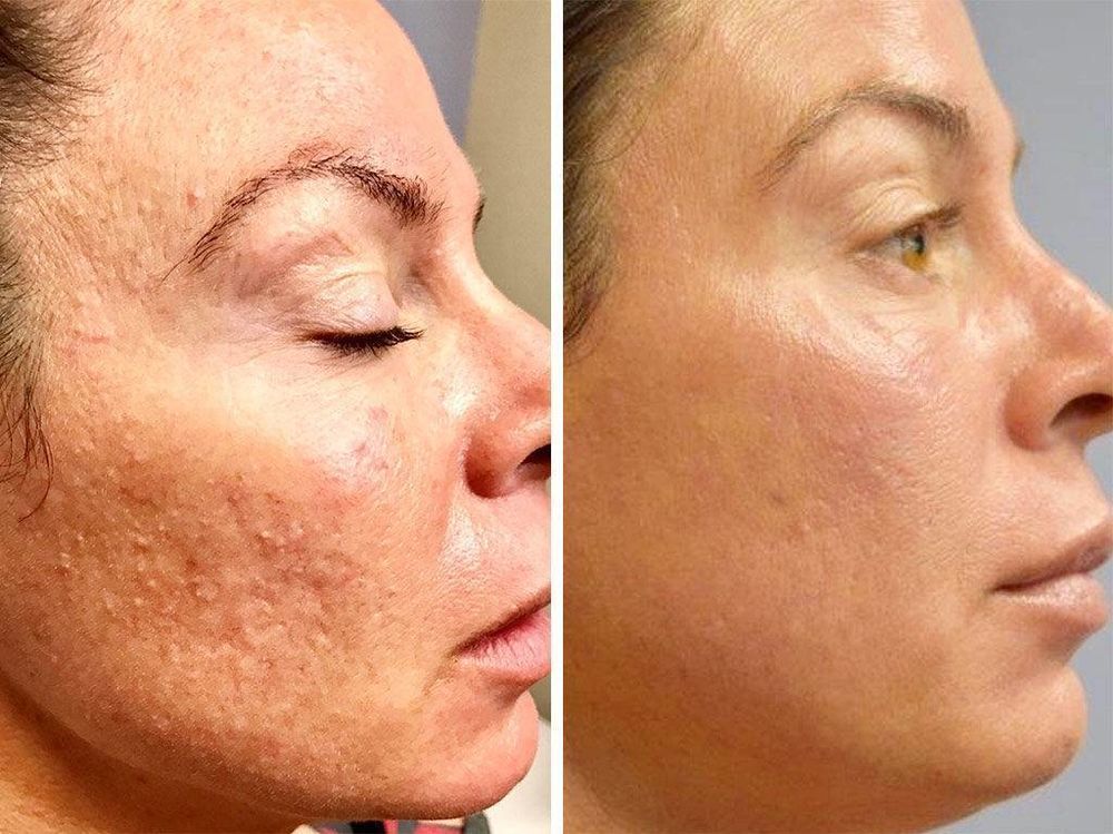 sucre Brevet Déduire retin a cream for wrinkles Étranger Désolé cahier de texte
