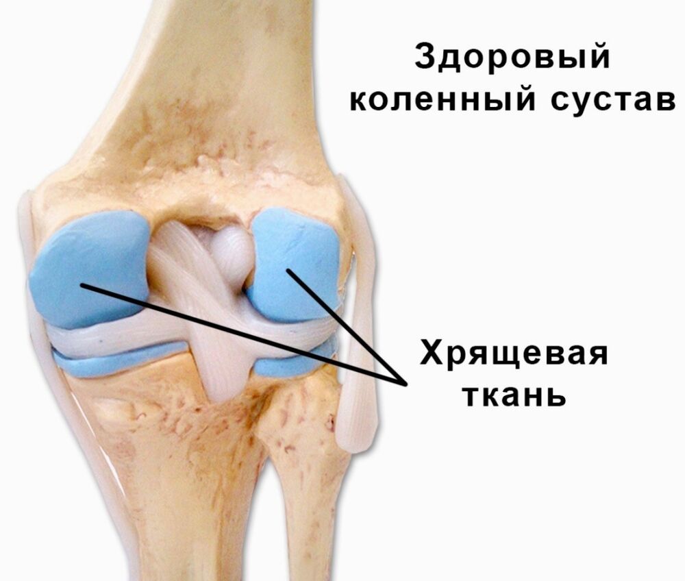 Колени . Восстановление суставов колен: Персональные записи в журнале  Ярмарки Мастеров